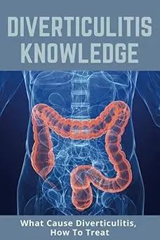 Diverticulitis Knowledge: What Cause Diverticulitis, How To Treat: Examples Of Low-Fiber Foods Paperback 1